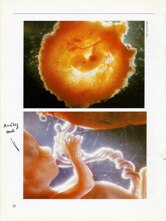 jeremiegrandsenne_arreteztout